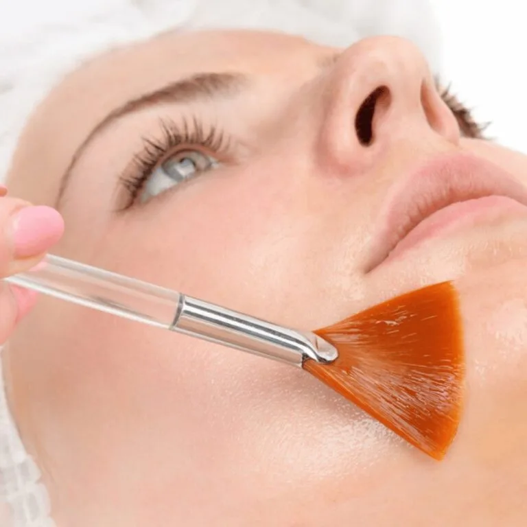 Chemical skin peel at Beauty Lounge St Kilda