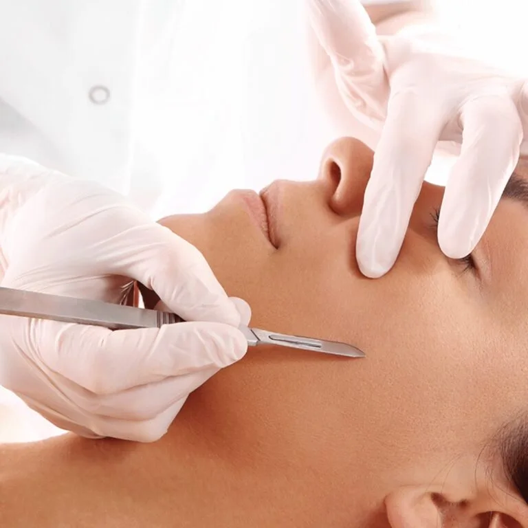 Epi-blading dermaplaning treatment at Beauty Lounge St Kilda